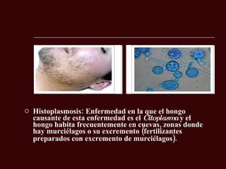 Histoplasmosis: Enfermedad en la que el hongo causante de esta enfermedad es el  Citoplasma  y el hongo habita frecuentemente en cuevas, zonas donde hay murciélagos o su excremento (fertilizantes preparados con excremento de murciélagos).     