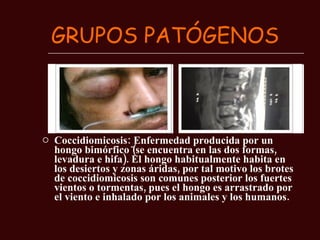 GRUPOS PATÓGENOS Coccidiomicosis:   Enfermedad producida por un hongo bimórfico (se encuentra en las dos formas, levadura e hifa). El hongo habitualmente habita en los desiertos y zonas áridas, por tal motivo los brotes de coccidiomicosis son comunes posterior los fuertes vientos o tormentas, pues el hongo es arrastrado por el viento e inhalado por los animales y los humanos. 