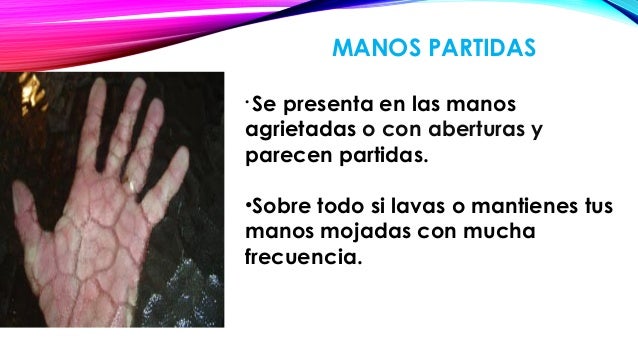 Que es mejor el ungüento del hongo en los pies más vale las revocaciones