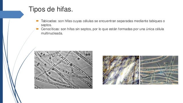 Los Hongos 1 Los Hongos 1
