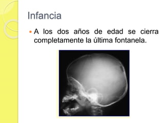 Infancia
 A los dos años de edad se cierra
completamente la última fontanela.
 