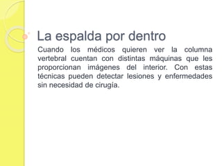 La espalda por dentro
Cuando los médicos quieren ver la columna
vertebral cuentan con distintas máquinas que les
proporcionan imágenes del interior. Con estas
técnicas pueden detectar lesiones y enfermedades
sin necesidad de cirugía.
 