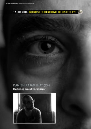 Losing sight in kashmir the impact of pellet firing shotguns | PDF
