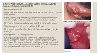 Major Ras Reccurent Aphthous Stomatitis (RAS) / Stomatitis Aftosa Rekuren | PPTX