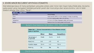 Major Ras Reccurent Aphthous Stomatitis (RAS) / Stomatitis Aftosa Rekuren | PPTX