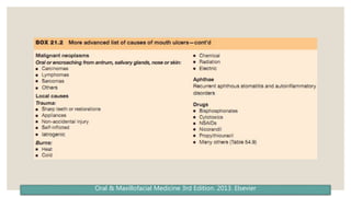 Major Ras Reccurent Aphthous Stomatitis (RAS) / Stomatitis Aftosa Rekuren | PPTX
