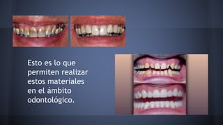 Esto es lo que
permiten realizar
estos materiales
en el ámbito
odontológico.
 