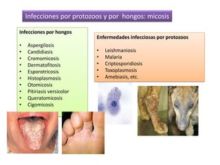 Términos de epidemiología