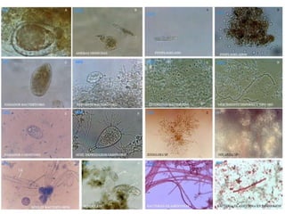 Industria farmacéuticaEl producto más importante que generan los microorganismos en relación a la industria farmacéutica son los antibióticos. En biología, un antibiótico es una sustancia química que a bajas concentraciones mata o impide el crecimiento de ciertas clases de microorganismos sensibles. Normalmente un antibiótico es inofensivo para el huésped, aunque puede producirse una reacción adversa al medicamento o afectar a la flora bacteriana normal del organismo. Se espera que la toxicidad de los antibióticos sea superior para los organismos invasores que para los animales o los seres humanos que los hospedan