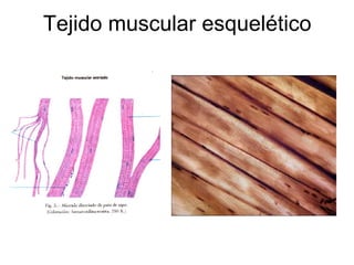 Tejido muscular esquelético
 