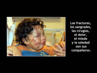 Las fracturas,  los sangrados,  las cirugías,  el dolor,  el miedo  y la soledad  son sus compañeros. 