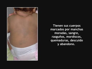 Tienen sus cuerpos marcados por manchas moradas, sangre, rasguños, mordiscos, quemaduras, descuido y abandono.  