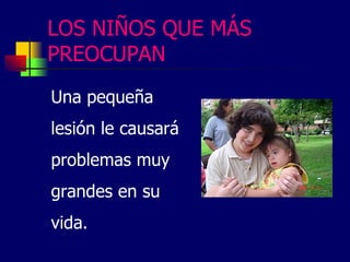 LOS NIÑOS QUE MÁS
PREOCUPAN
Una pequeña
lesión le causará
problemas muy
grandes en su
vida.