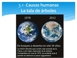 3.1- Causas humanas
La tala de árboles
 