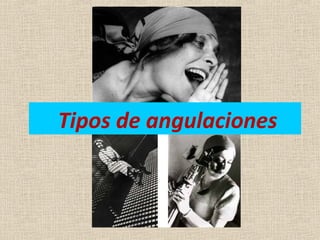 Tipos de angulaciones
 