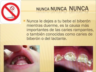 Nunca le dejes a tu bebe el biberón mientras duerme, es la causa más importantes de las caries rampantes, o también conocidas como caries de biberón o del lactante. 