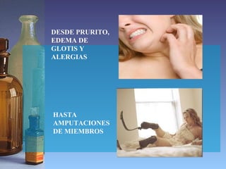HASTA AMPUTACIONES DE MIEMBROS DESDE PRURITO, EDEMA DE GLOTIS Y ALERGIAS 