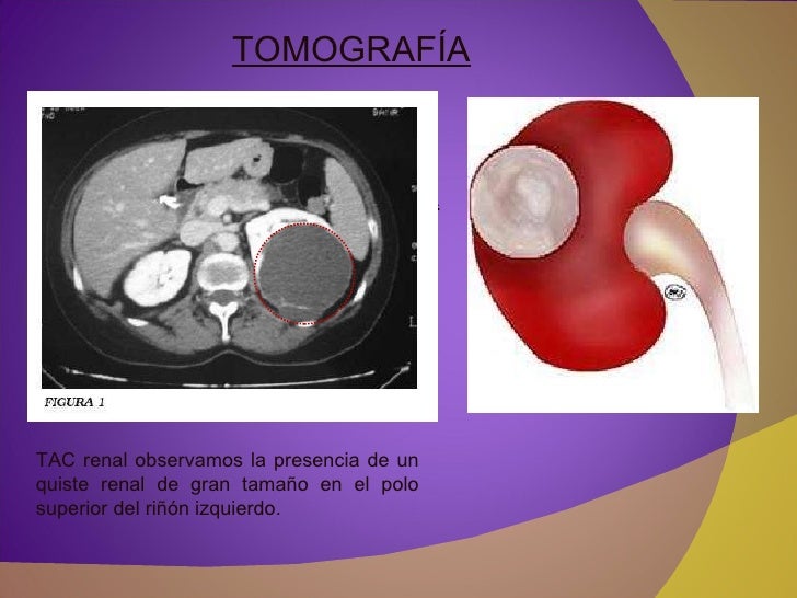 Los riñones