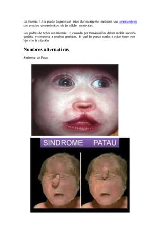 La trisomía 13 se puede diagnosticar antes del nacimiento mediante una amniocentesis
con estudios cromosómicos de las células amnióticas.
Los padres de bebés con trisomía 13 causada por translocación deben recibir asesoría
genética y someterse a pruebas genéticas, lo cual les puede ayudar a evitar tener otro
hijo con la afección.
Nombres alternativos
Síndrome de Patau
 
