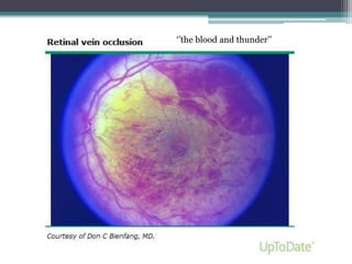 ‘’the blood and thunder’’
 