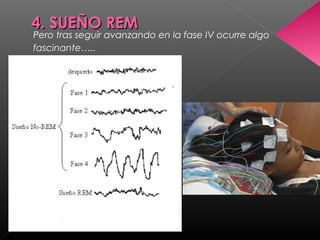 4. SUEÑO REM4. SUEÑO REM
Pero tras seguir avanzando en la fase IV ocurre algo
fascinante…..
 