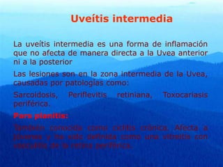 Uveítis intermedia
La uveítis intermedia es una forma de inflamación
que no afecta de manera directa a la Uvea anterior
ni a la posterior
Las lesiones son en la zona intermedia de la Uvea,
causadas por patologías como:
Sarcoidosis, Periflevitis retiniana, Toxocariasis
periférica.
Pars planitis:
También conocida como ciclitis crónica. Afecta a
jóvenes y ha sido definida como una vitreitis con
vasculitis de la retina periférica.
 