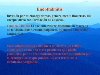 Endoftalmitis
Invasión por microorganismos, generalmente Bacterias, del
cuerpo vítreo con formación de absceso.
Cuadro Clínico: El paciente refiere disminución marcada
de la visión, dolor, edema palpebral, quemosis e inyección
conjuntival.
En la oftalmoscopía a distancia se observa un reflejo
amarillento como una masa purulenta que puede
producirse por un traumatismo penetrante así también por
microorganismos que pueden llegar a través de la
circulación sanguínea.
 