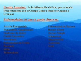Uveítis Anterior: Es la inflamación del Iris, que se asocia
frecuentemente con el Cuerpo Ciliar ( Puede ser Aguda o
Crónica)
Enfermedades en que se puede observar:
Artritis Reumatoide Enfermedad de Hansen
Espondilitis Anquilosante Herpes Zoster
Síndrome de Reiter Herpes Simple
Colitis Ulcerativa Adenovirus
Sarcoidosis Oncocercosis
Enfermedad de Crohn Leucemia
Psoriasis Gota
Sífilis
Tuberculosis
 