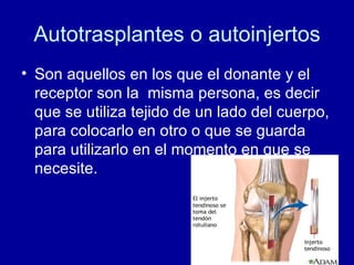 Autotrasplantes o autoinjertos Son aquellos en los que el donante y el receptor son la  misma persona, es decir que se utiliza tejido de un lado del cuerpo, para colocarlo en otro o que se guarda para utilizarlo en el momento en que se necesite. 