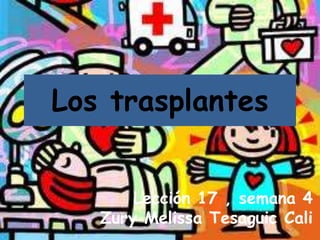 Los trasplantes


       Lección 17 , semana 4
   Zury Melissa Tesaguic Cali
 