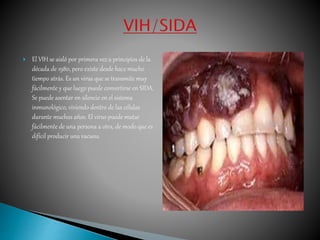  El VIH se aisló por primera vez a principios de la 
década de 1980, pero existe desde hace mucho 
tiempo atrás. Es un virus que se transmite muy 
fácilmente y que luego puede convertirse en SIDA. 
Se puede asentar en silencio en el sistema 
inmunológico, viviendo dentro de las células 
durante muchos años. El virus puede mutar 
fácilmente de una persona a otra, de modo que es 
difícil producir una vacuna. 
 