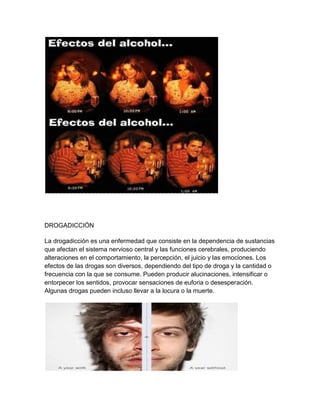 DROGADICCIÓN
La drogadicción es una enfermedad que consiste en la dependencia de sustancias
que afectan el sistema nervioso central y las funciones cerebrales, produciendo
alteraciones en el comportamiento, la percepción, el juicio y las emociones. Los
efectos de las drogas son diversos, dependiendo del tipo de droga y la cantidad o
frecuencia con la que se consume. Pueden producir alucinaciones, intensificar o
entorpecer los sentidos, provocar sensaciones de euforia o desesperación.
Algunas drogas pueden incluso llevar a la locura o la muerte.
 