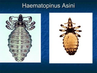 Haematopinus AsiniHaematopinus Asini
 