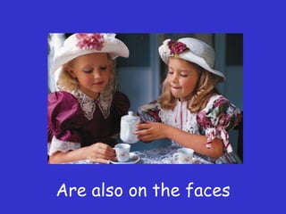 Are also on the faces
 