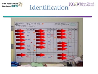 Falls (Acute Hospitals) & Irish Hip Fracture Database, AIGNA ...