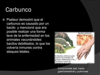 Carbunco


Pasteur demostró que el
carbunco es causado por un
bacilo y mencionó que era
posible realizar una forma
leve de la enfermedad en los
animales vacunándoles
bacilos debilitados, lo que los
volvería inmunes contra
ataques letales.

Compromete piel, tracto
gastrointestinal y pulmones

 