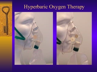 Hyperbaric Oxygen Therapy 