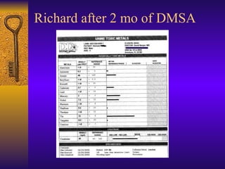 Richard after 2 mo of DMSA 