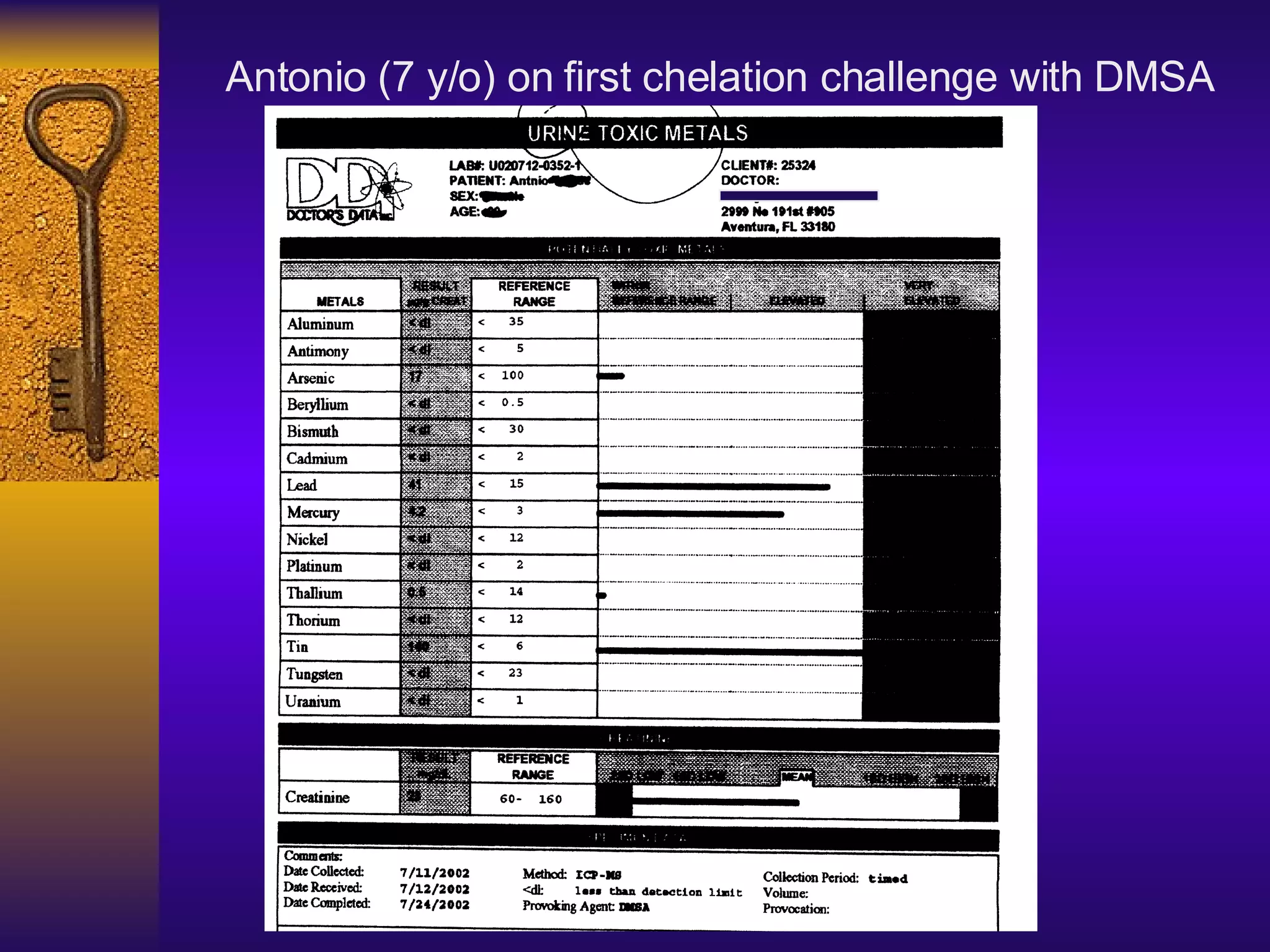 Antonio (7 y/o) on first chelation challenge with DMSA 