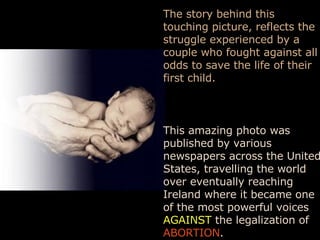 The story behind this touching picture, reflects the struggle experienced by a couple who fought against all odds to save the life of their first child. This amazing photo was published by various newspapers across the United States, travelling the world over eventually reaching Ireland where it became one of the most powerful voices  AGAINST  the legalization of  ABORTION .  
