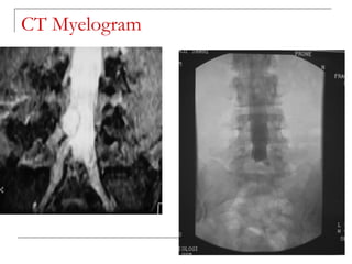 CT Myelogram
 