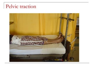 Pelvic traction
 