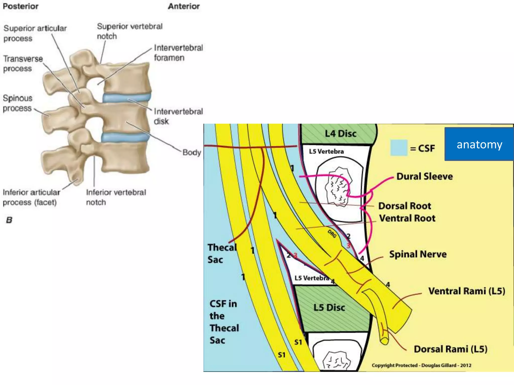 Low back pain | PPTX