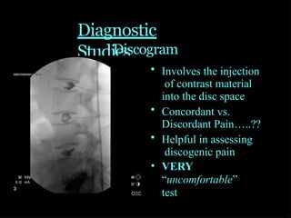 low back pain causes and deferential diagnosis.pptx