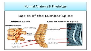 Low back pain by Dr.bagasi | PPT