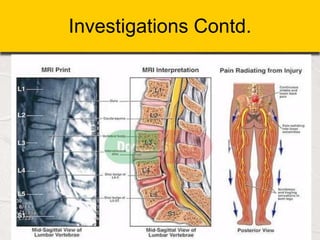 Investigations Contd.
 