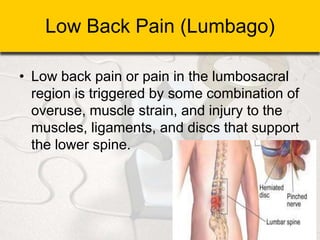 Low Back Pain (Lumbago)
• Low back pain or pain in the lumbosacral
region is triggered by some combination of
overuse, muscle strain, and injury to the
muscles, ligaments, and discs that support
the lower spine.
 