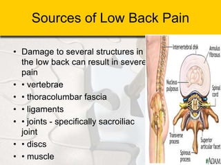 Sources of Low Back Pain
• Damage to several structures in
the low back can result in severe
pain
• • vertebrae
• • thoracolumbar fascia
• • ligaments
• • joints - specifically sacroiliac
joint
• • discs
• • muscle
 