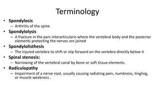 Terminology
• Spondylosis
– Arthritis of the spine
• Spondylolysis
– A fracture in the pars interarticularis where the vertebral body and the posterior
elements protecting the nerves are joined
• Spondylolisthesis
– The injured vertebra to shift or slip forward on the vertebra directly below it
• Spinal stenosis:
– Narrowing of the vertebral canal by bone or soft tissue elements.
• Radiculopathy
– Impairment of a nerve root, usually causing radiating pain, numbness, tingling,
or muscle weakness .
 