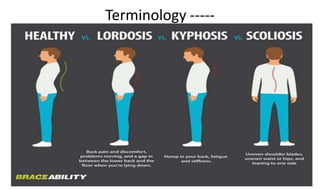 Terminology -----
 